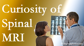 Auburn MRIs for spinal stenosis may be revealing…or confusing.