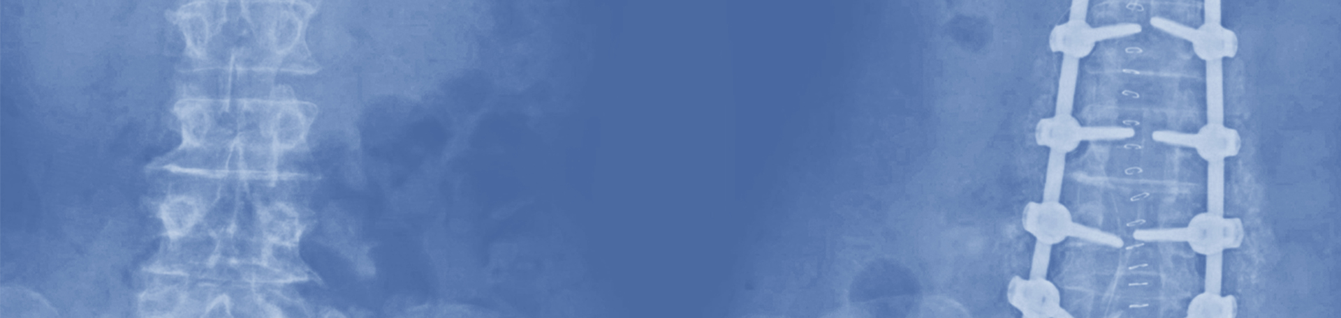 /corporate/images/bananer-double-size-pscp-2-23-480.jpg