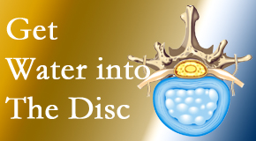 Dr. Le's Chiropractic & Wellness, L.L.C. uses spinal manipulation and exercise to enhance the diffusion of water into the disc which supports the health of the disc.