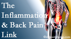 Dr. Le's Chiropractic & Wellness, L.L.C. addresses the inflammatory process that accompanies back pain as well as the pain itself.