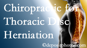 Dr. Le's Chiropractic & Wellness, L.L.C. diagnoses and manages thoracic disc herniation pain and relieves its symptoms like unexplained abdominal pain or other gastrointestinal issues. 