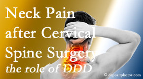 Dr. Le's Chiropractic & Wellness, L.L.C. offers gentle care for neck pain after neck surgery.