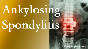 Ankylosing spondylitis is gently cared for by your Auburn chiropractor.