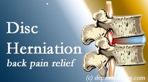 Dr. Le's Chiropractic & Wellness, L.L.C. offers non-surgical treatment for relief of disc herniation related back pain. 