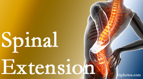Dr. Le's Chiropractic & Wellness, L.L.C. understands the role of extension in spinal motion, its necessity, its benefits and potential harmful effects. 