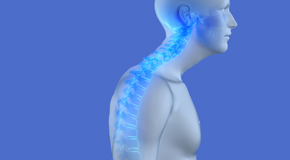 relief of Auburn kyphosis pain
