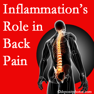 The role of inflammation in Auburn back pain is real. Chiropractic care can help.