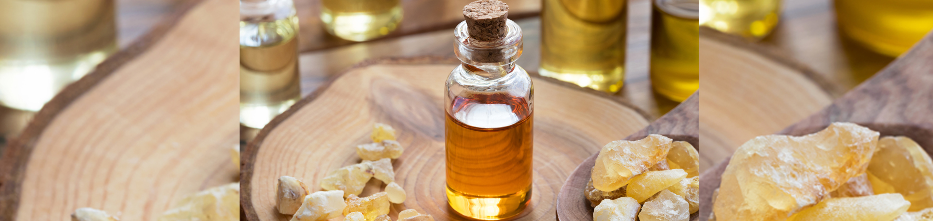 Auburn anti-inflammatory frankincense