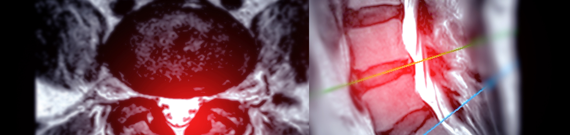 Auburn back pain imaging and exercise