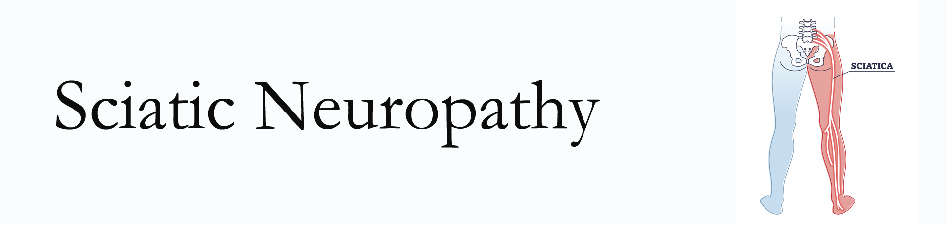 Auburn neuropathy pain (sciatica) 