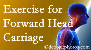 Auburn chiropractic treatment of forward head carriage is two-fold: manipulation and exercise.