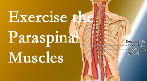 Dr. Le's Chiropractic & Wellness, L.L.C. describes the importance of paraspinal muscles and their strength for Auburn back pain relief.