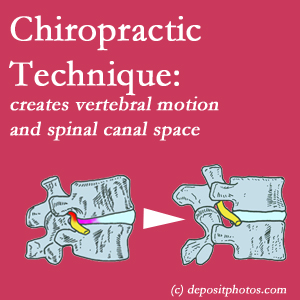 picture of a Auburn spinal stenotic canal