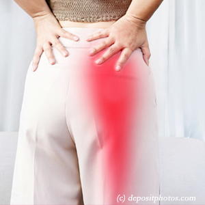 picture of Auburn leg pain, sciatica, lumbar radiculopathy