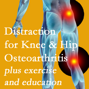 A chiropractic treatment plan for Auburn knee pain and hip pain caused by osteoarthritis: education, exercise, distraction.