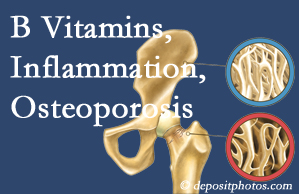 Auburn chiropractic care of osteoporosis often comes with nutritional tips like b vitamins for inflammation reduction and for prevention.