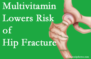 Auburn hip fracture risk is reduced by multivitamin supplementation. 