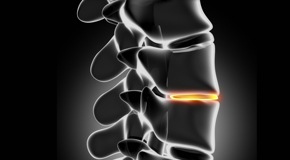 Auburn chiropractic nutrition with vitamin D and quercitrin