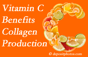 Auburn chiropractic offers tips on nutrition like vitamin C for boosting collagen production that decreases in musculoskeletal conditions.